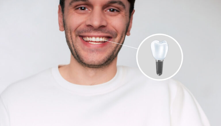 A young man happy with dental implants